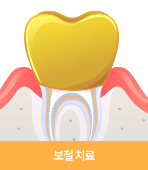 보철 치료