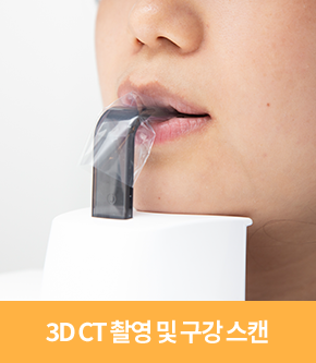 3D CT 촬영 및 구강 스캔